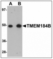 AP23954PU-N - TMEM184B