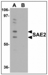 AP23957PU-N - SAE2 / UBA2