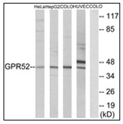 AP23837PU-N - GPR52