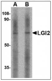 AP23844PU-N - LGI2