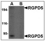 AP23846PU-N - RGPD5 / RGPD6