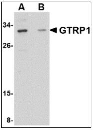 AP23848PU-N - GRTP1 / TBC1D6