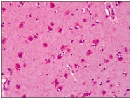 AP23851PU-N - Syntaphilin / SNPH