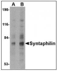 AP23851PU-N - Syntaphilin / SNPH