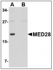 AP23858PU-N - MED28