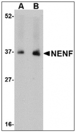 AP23859PU-N - Neudesin