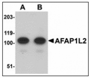 AP23877PU-N - AFAP1L2