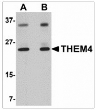 AP23880PU-N - THEM4 / CTMP