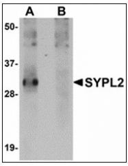 AP23882PU-N - SYPL2