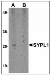 AP23888PU-N - SYPL1 / Pantophysin