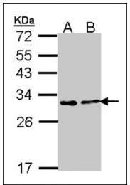 AP23896PU-N - FKBP3 / FKBP25