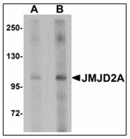 AP23899PU-N - JMJD2A / KDM4A