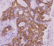AM09381PU-N - Cytokeratin 18