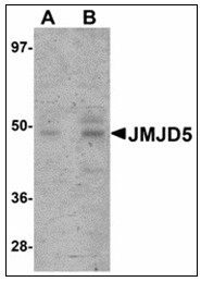 AP23901PU-N - JMJD5