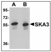 AP23904PU-N - SKA3