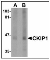 AP23907PU-N - PLEKHO1 / CKIP1