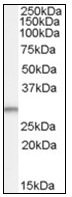 AP23830PU-N - Tumor protein D54 (TPD52L2)
