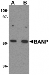 AP26271PU-N - BANP / SMAR1