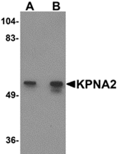 AP26275PU-N - KPNA2 / Importin alpha-2