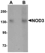 AP26257PU-N - NOD3