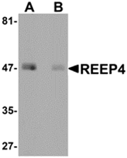 AP26198PU-N - REEP4