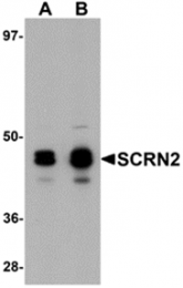 AP26236PU-N - Secernin-2 (SCRN2)