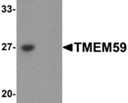 AP26305PU-N - TMEM59