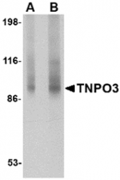 AP26187PU-N - Transportin-3 (TNPO3)