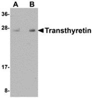 AP26193PU-N - Transthyretin / Prealbumin