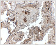 AP26193PU-N - Transthyretin / Prealbumin