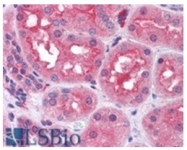 AP31109PU-N - PREP / PEP