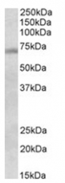 AP31104PU-N - DBF4 / ASK