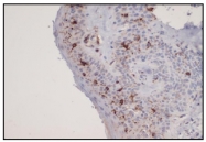 DB 071-1 - CD1a