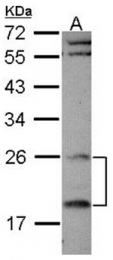 AP31123PU-N - RGS4