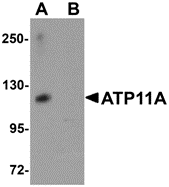 AP26238CP-N - ATP11A