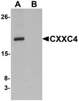 AP26295CP-N - CXXC4