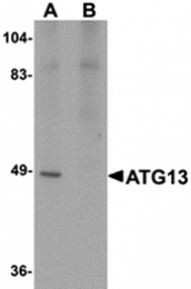 AP26240CP-N - ATG13