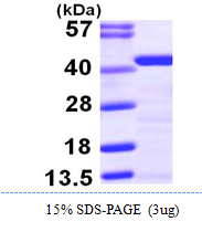 AR09813PU-N - Tropomyosin-2 (TPM2)