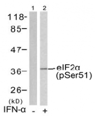 AP02522PU-S - EIF2A / EIF2S1