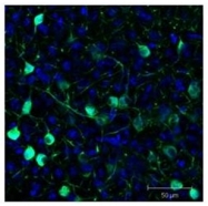 R1091B - GFP