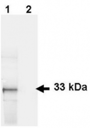 R1091B - GFP