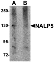 AP26262CP-N - NLRP5