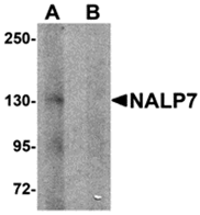 AP26264CP-N - NLRP7