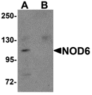 AP26260CP-N - NALP9 / NOD6