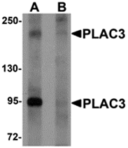 AP26287CP-N - Pappalysin-2 / PAPPA2