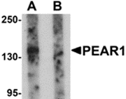 AP26298CP-N - PEAR1