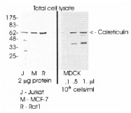AP05311PU-N - Calreticulin