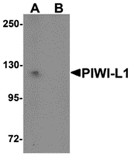 AP26292CP-N - PIWIL1