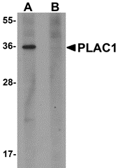 AP26285CP-N - PLAC1
