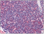 AP09011PU-N - CD127 / IL7R